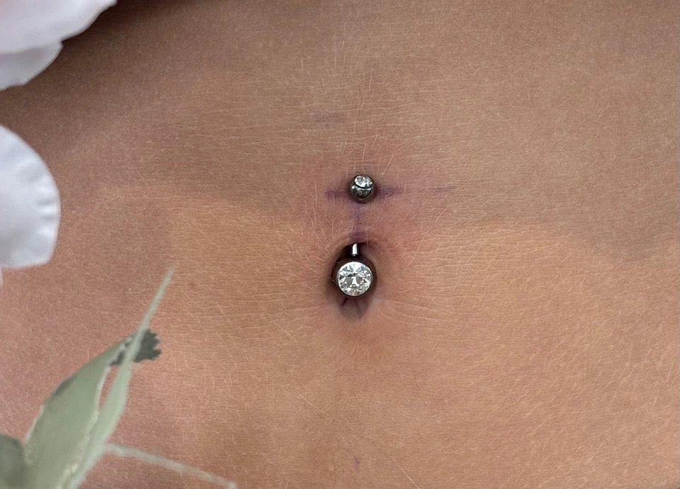 Gros plan sur un double piercing de nombril avec des bijoux sertis de cristaux étincelants et des marques de stylo chirurgical.